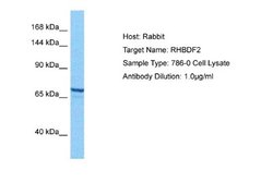RHBDF2 Rabbit anti-Human, Polyclonal, Novus Biologicals 0.1ml; Unconjugated:Antibodies,